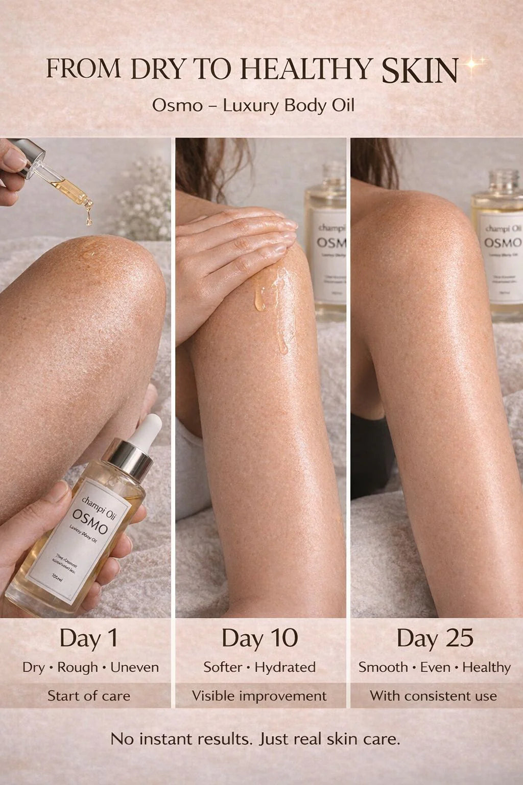 Dry to healthy skin progression on legs after consistent use of Champi Oil Osmo.