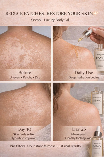 Before and after results showing reduction of dry skin patches with Champi Oil Osmo.