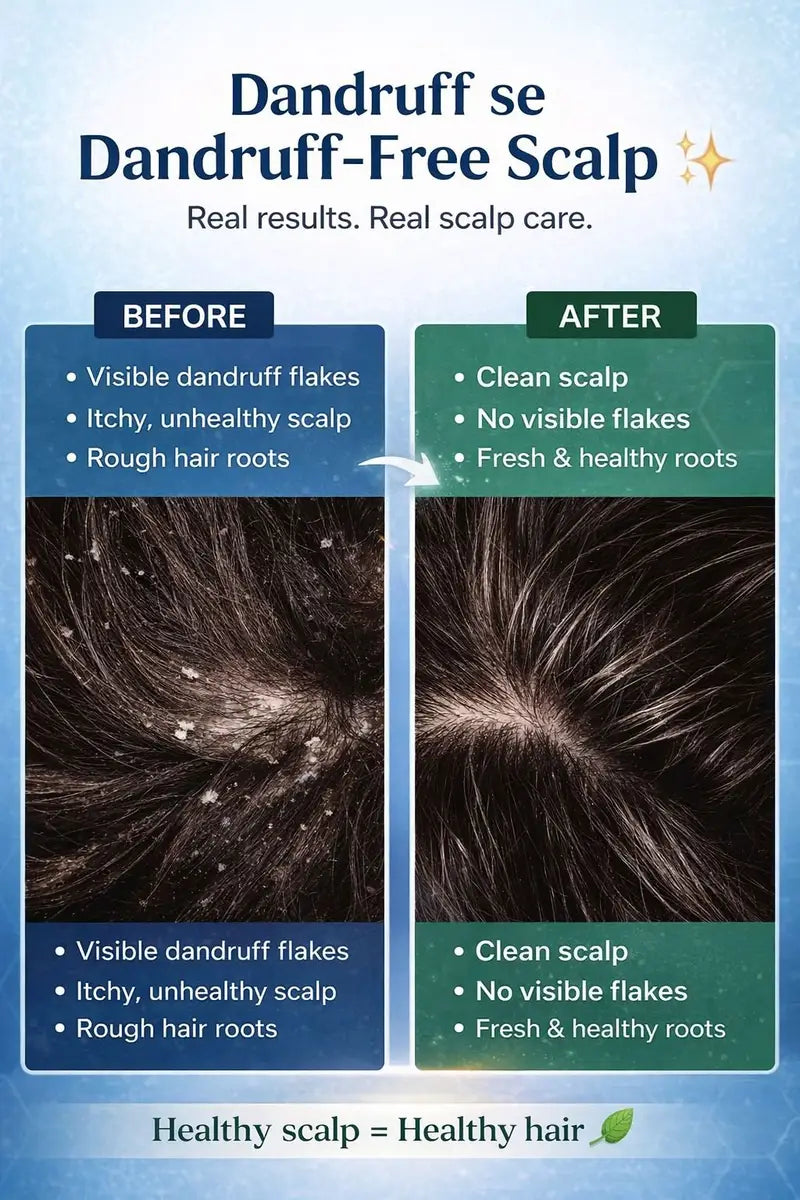 Before and after dandruff treatment showing clean scalp and healthy hair roots
