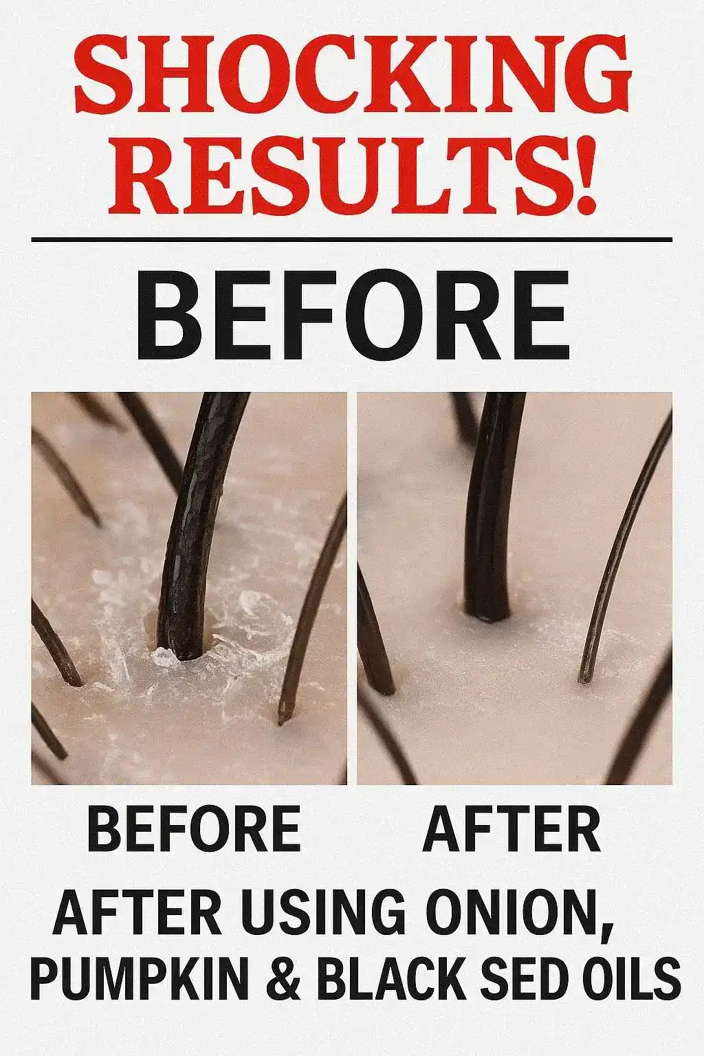 Scalp transformation showing follicles after Extreme Hairfall Treatment with botanical oils.