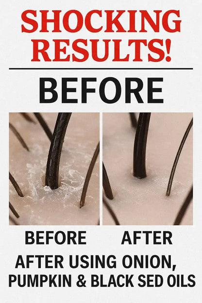 Scalp transformation showing follicles after Extreme Hairfall Treatment with botanical oils.